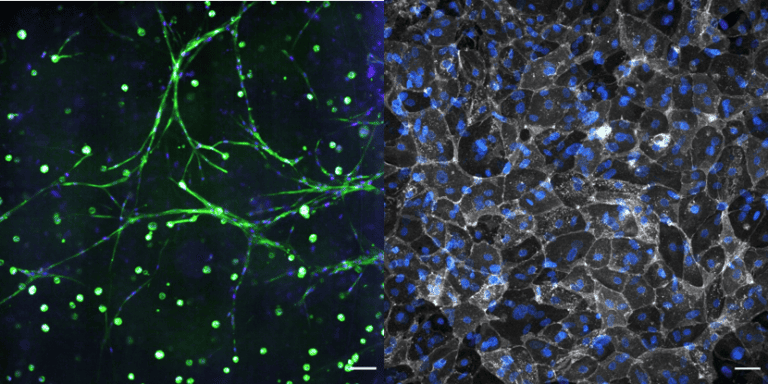 Lymph Node-on-a-Chip Model Advances Immune Research at VA Tech